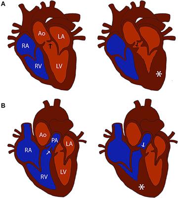 Congenital Cardiac Outflow Tract Abnormalities in Dogs: Prevalence and Pattern of Inheritance From 2008 to 2017